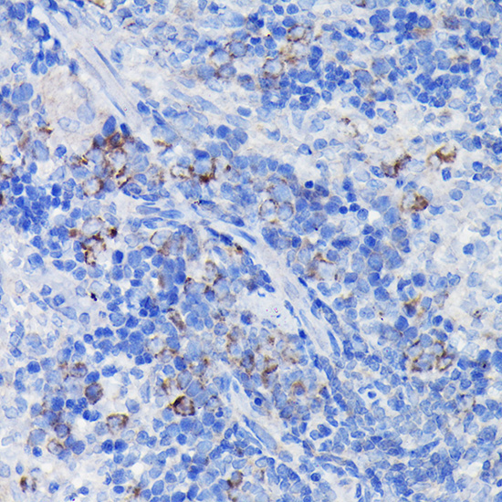 Clusterin alpha chain Rabbit Polyclonal Antibody - Image 2