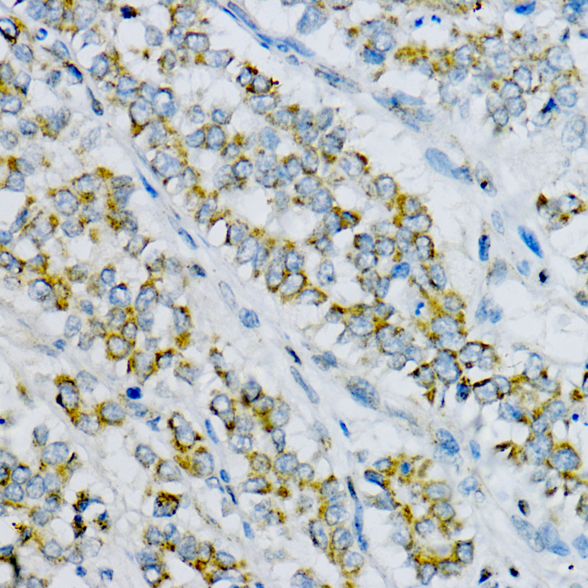 Clusterin Rabbit Polyclonal Antibody - Image 2