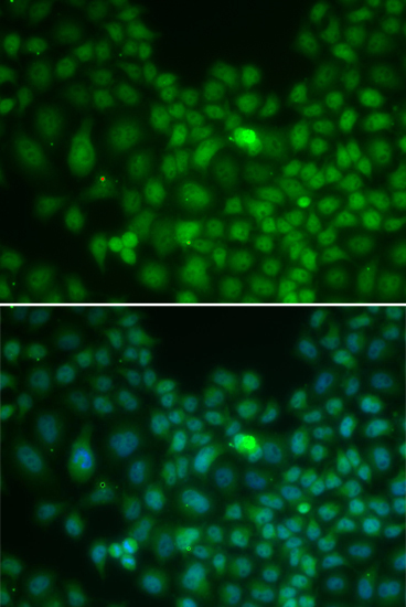 Clusterin Rabbit Polyclonal Antibody - Image 4
