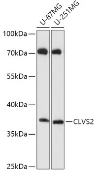 CLVS2 Rabbit Polyclonal Antibody