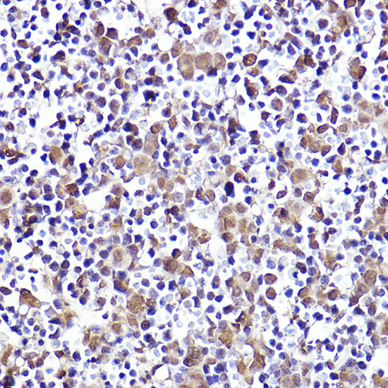 CMIP Rabbit Polyclonal Antibody - Image 3