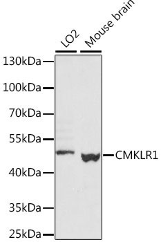 CMKLR1 Rabbit Polyclonal Antibody