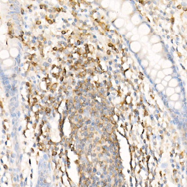 CMTM3 Rabbit Polyclonal Antibody