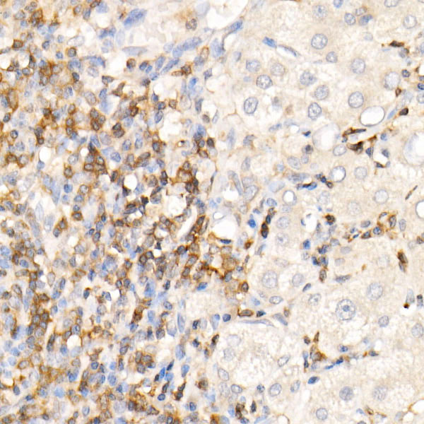 CMTM3 Rabbit Polyclonal Antibody - Image 2