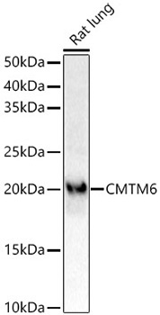 CMTM6 Rabbit Monoclonal Antibody - Image 2