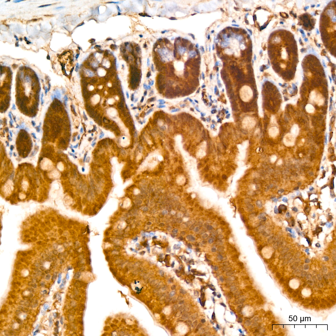 CNBP Rabbit Polyclonal Antibody - Image 4