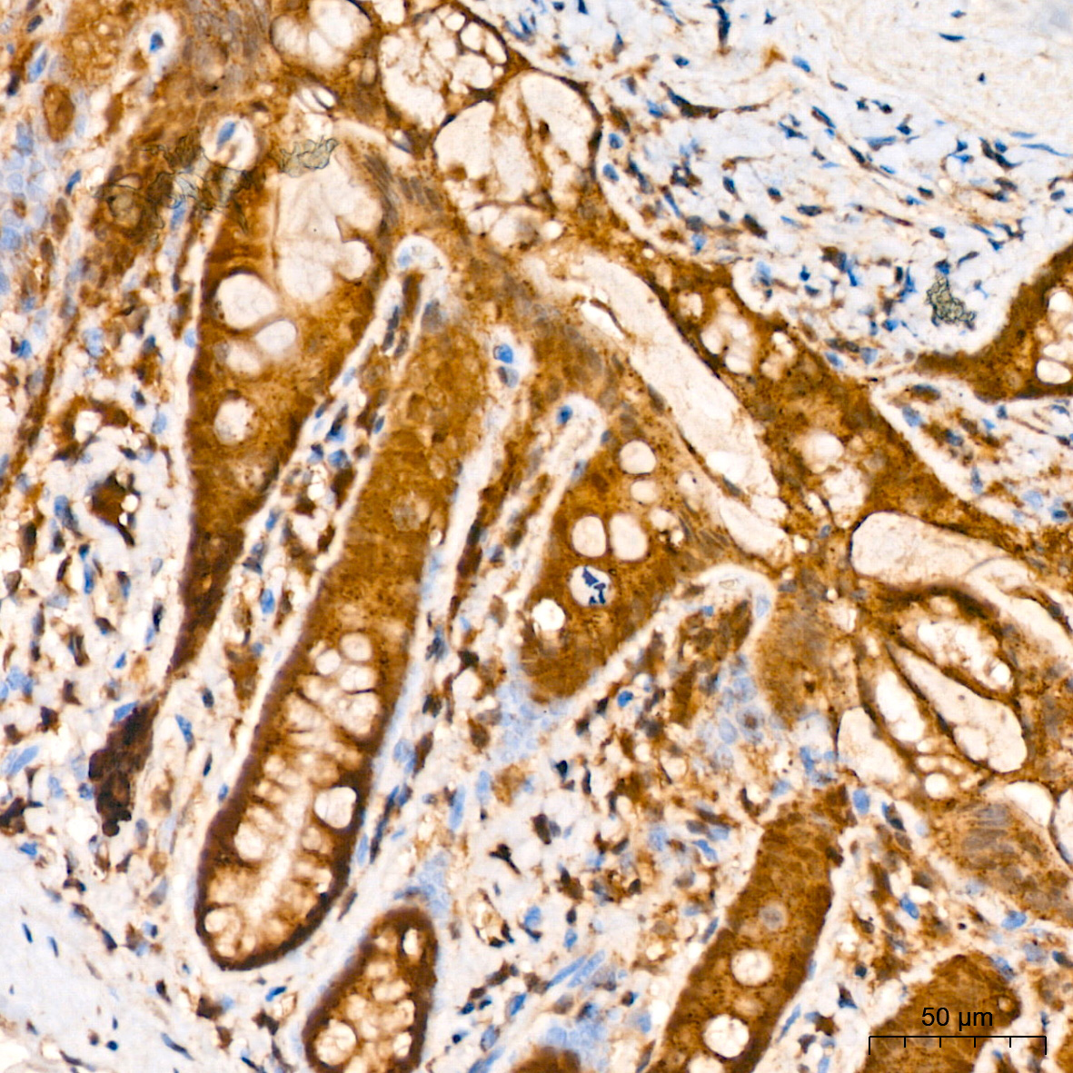 CNBP Rabbit Polyclonal Antibody - Image 5