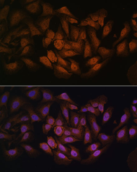 CNBP Rabbit Polyclonal Antibody - Image 6