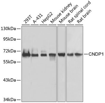 CNDP1 Rabbit Polyclonal Antibody
