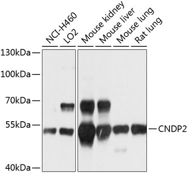 CNDP2 Rabbit Polyclonal Antibody