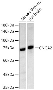 CNGA2 Rabbit Polyclonal Antibody - Image 2
