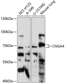 CNGA4 Rabbit Polyclonal Antibody