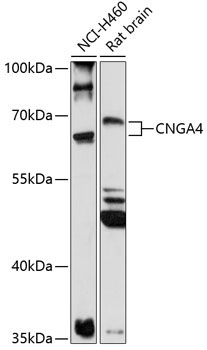 CNGA4 Rabbit Polyclonal Antibody