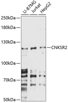 CNKSR2 Rabbit Polyclonal Antibody