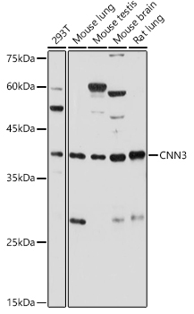 CNN3 Rabbit Polyclonal Antibody