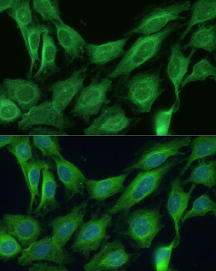 CNNM1 Rabbit Polyclonal Antibody - Image 2