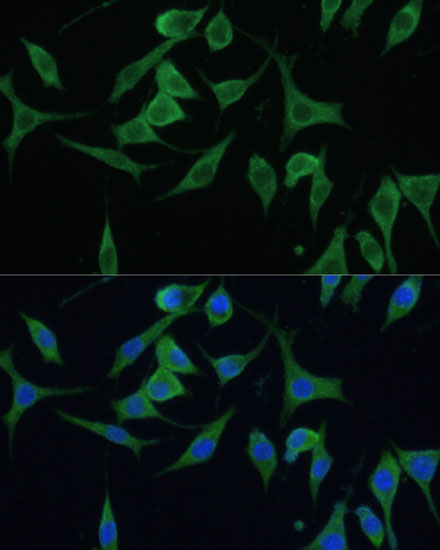 CNNM1 Rabbit Polyclonal Antibody - Image 3