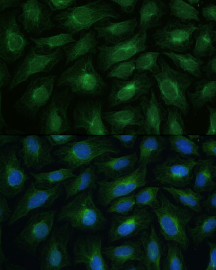 CNNM1 Rabbit Polyclonal Antibody - Image 4