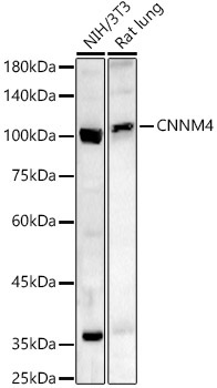 CNNM4 Rabbit Polyclonal Antibody