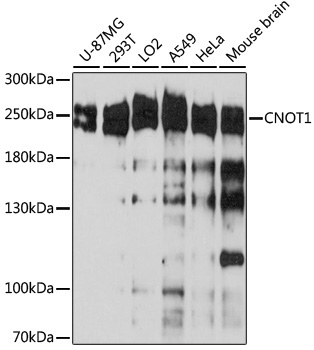 CNOT1 Rabbit Polyclonal Antibody