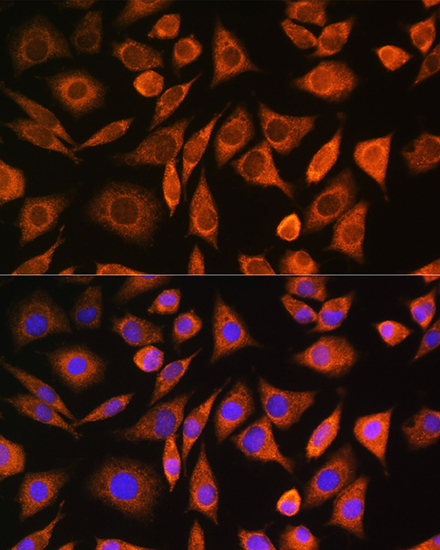CNOT1 Rabbit Polyclonal Antibody - Image 2