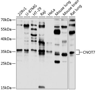 CNOT7 Rabbit Polyclonal Antibody