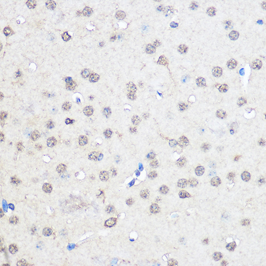 CNOT7 Rabbit Polyclonal Antibody - Image 2