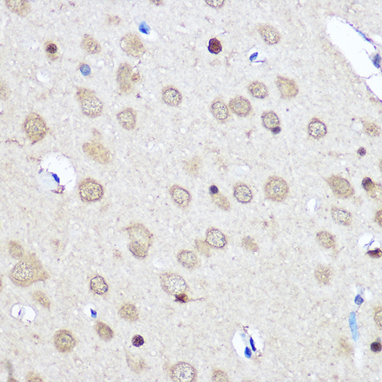 CNOT7 Rabbit Polyclonal Antibody - Image 3