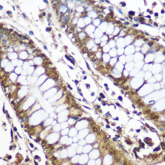 CNOT7 Rabbit Polyclonal Antibody - Image 4