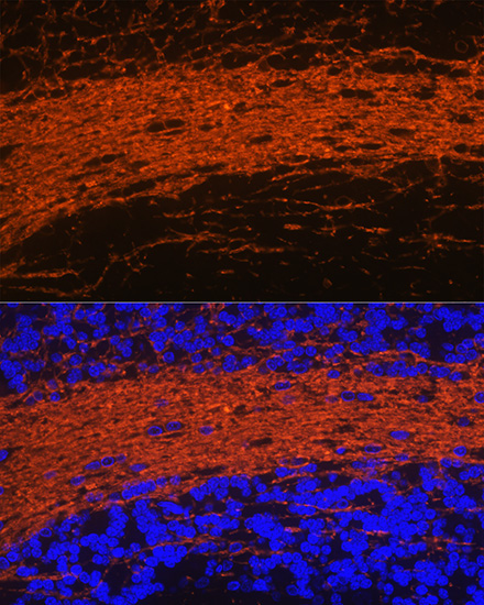 CNPase Rabbit Polyclonal Antibody - Image 2