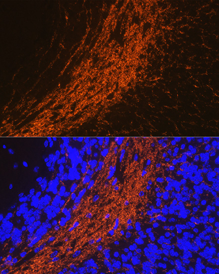 CNPase Rabbit Polyclonal Antibody - Image 3