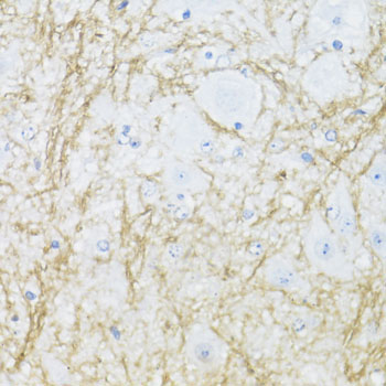 CNPase Rabbit Polyclonal Antibody - Image 3