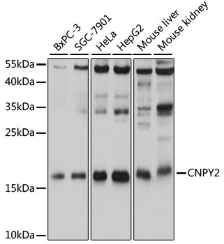 CNPY2 Rabbit Polyclonal Antibody