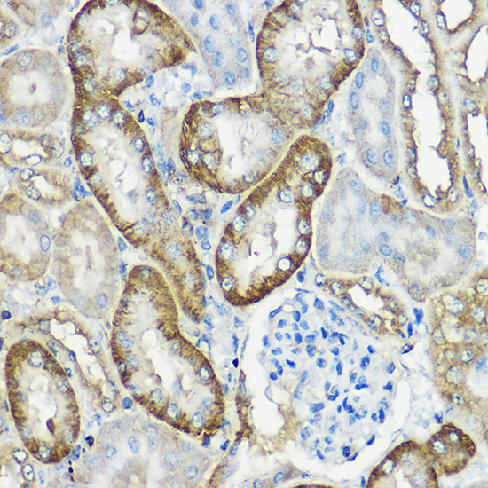 CNPY2 Rabbit Polyclonal Antibody - Image 2