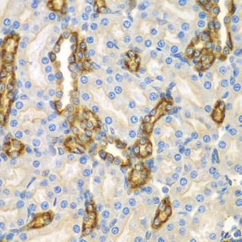 CNPY3 Rabbit Polyclonal Antibody - Image 2