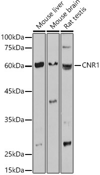CNR1 Rabbit Polyclonal Antibody