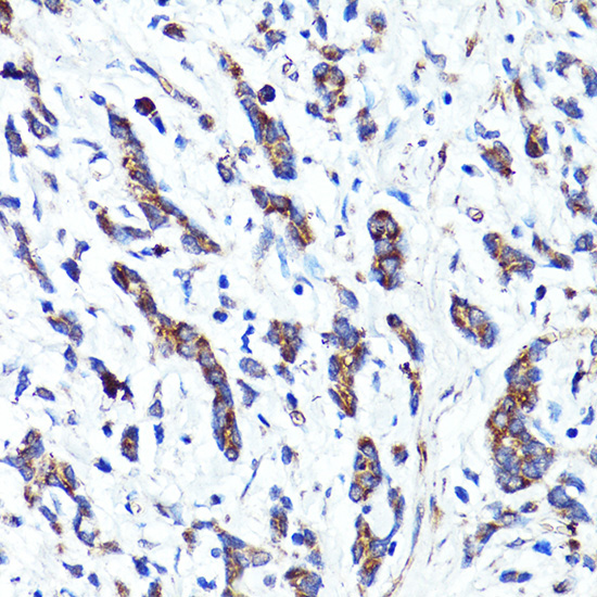 CNR1 Rabbit Polyclonal Antibody - Image 2