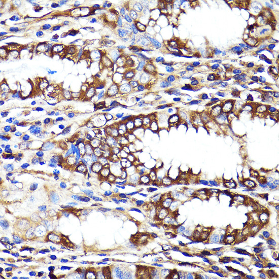 CNR1 Rabbit Polyclonal Antibody - Image 3