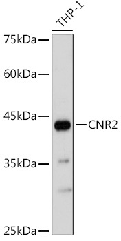 CNR2 Rabbit Polyclonal Antibody - Image 2