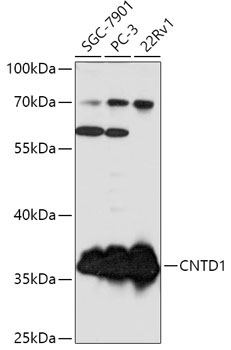 CNTD1 Rabbit Polyclonal Antibody