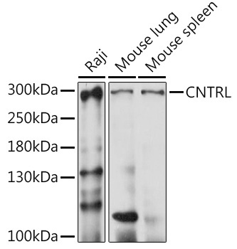 CNTRL Rabbit Polyclonal Antibody