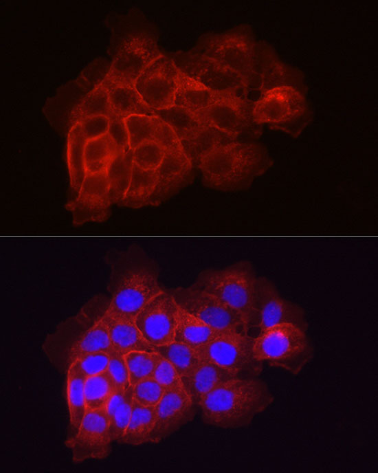 Coagulation factor III/Tissue Factor Rabbit Polyclonal Antibody - Image 3