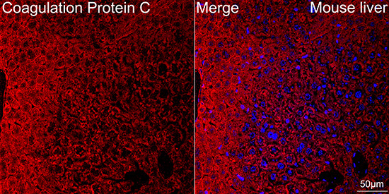 Coagulation Protein C Rabbit Monoclonal Antibody - Image 2