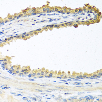 COCH Rabbit Polyclonal Antibody