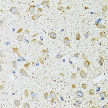 COG2 Rabbit Polyclonal Antibody - Image 2