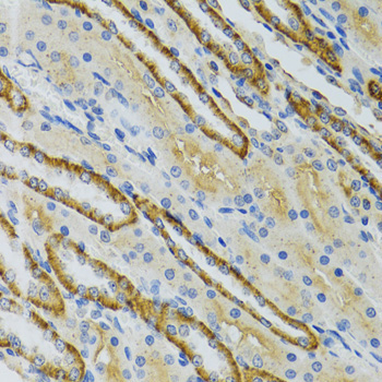 COG2 Rabbit Polyclonal Antibody - Image 3