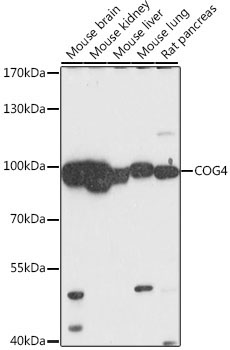 COG4 Rabbit Polyclonal Antibody