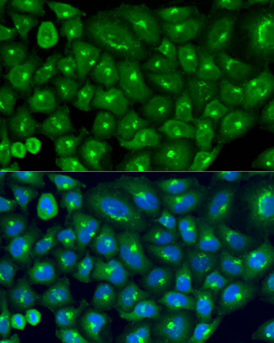COG7 Rabbit Polyclonal Antibody