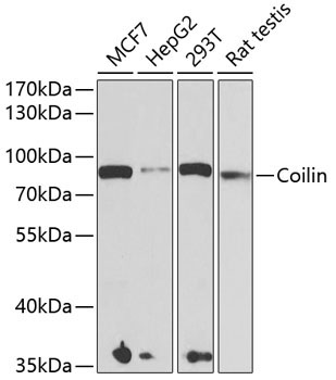 Coilin Rabbit Polyclonal Antibody