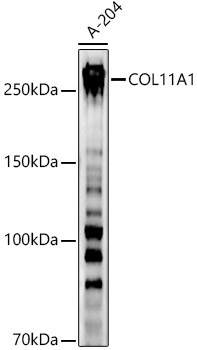 COL11A1 Rabbit Polyclonal Antibody